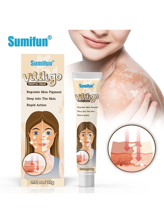 Vitiligo Removal Cream, Skin Vitiligo Treatment, Vitiligo Care Cream Reduces White Spots and Improves Skin Pigmentation (20g)