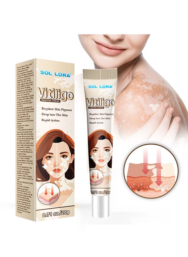 Vitiligo Removal Cream, Vitiligo Care Cream for Skin Vitiligo, Psoriasis, Leukoplakia, Reduces White Spots, Improve Skin Pigmentation Regulating 20g