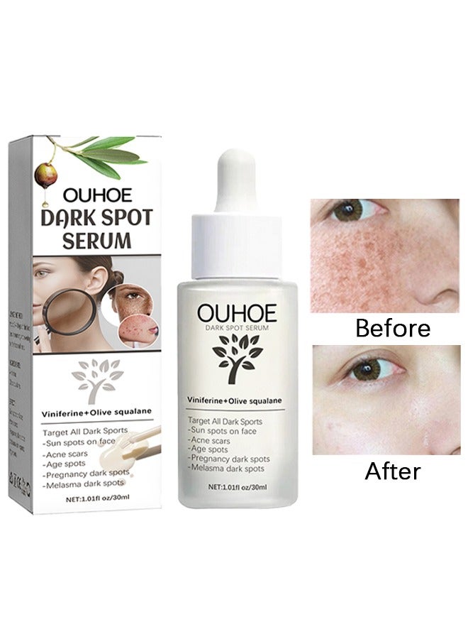Dark Spot Serum - Lightens Blemishes, Moisturises Skin, Repairs Acne Marks and Brightens Dullness of the Face