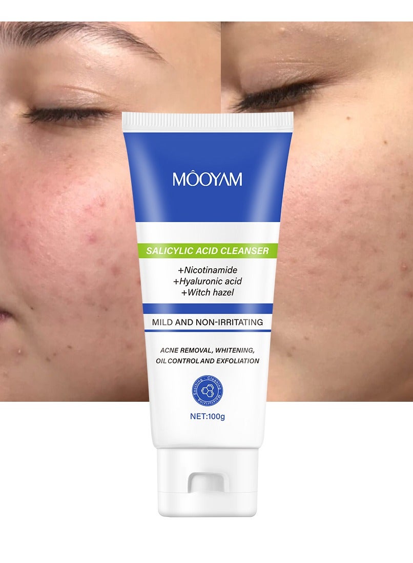 Salicylic Acid Cleanser for Acne, Deeply Cleanses & Exfoliates Acne Removal, Whitening, Oil Control and Exfoliation for All Skin 100g