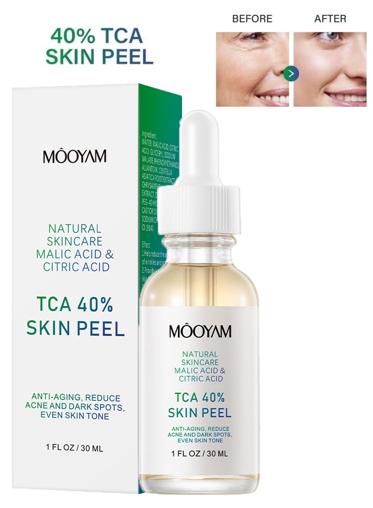 40% Citric Acid Peeling Serum Chemical Peel for Face Peeling Solution Skin Peel Chemical Exfoliant for Face Exfoliating Facial Peel for Dark Skin Dark Spots Acne Spot 30ml