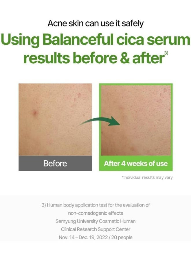 Balanceful Cica Serum 50Ml – Soothing Centella Asiatica Hydrating Serum For Sensitive, Oily & Acne-Prone Skin, 1.69 Fl Oz - image 3
