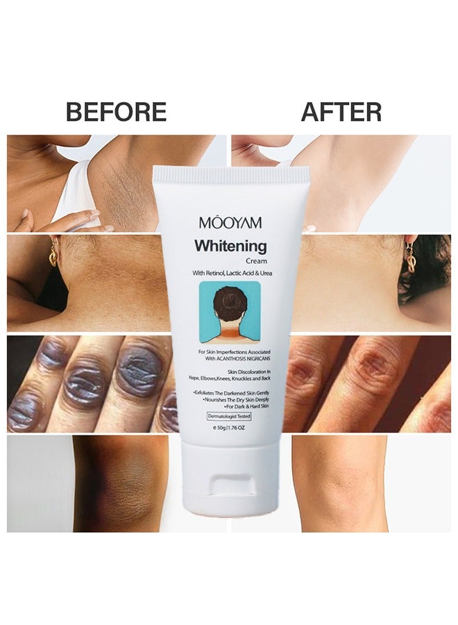Whitening Cream With Retional,Lactic Acid & Urea - Dermatologist Tested Retinol Cream , Hyperpigmentation Removal Cream , For Dark Body Parts like Neck Ankles Knuckles Armpits 50g