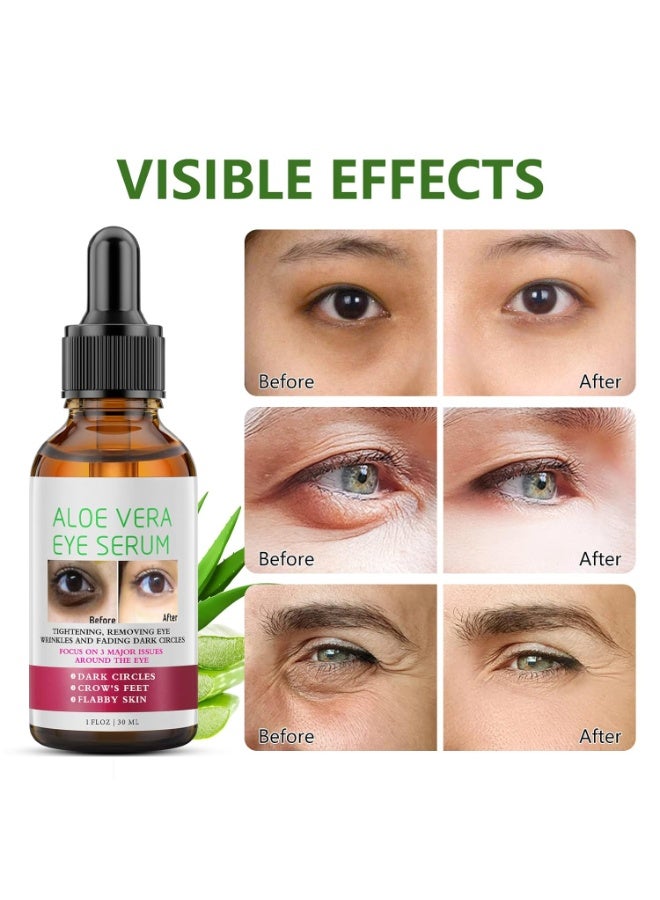 Aloe Vera Eye Serum 30ml for Dark Circles and Fine Lines Anti Aging Treatment Reduces Crows Feet and Wrinkles