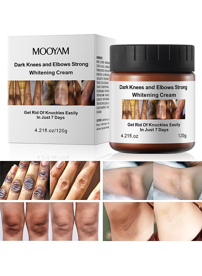 Dark Knees And Elbows Strong Whitening Cream, Get Rid Of Knuckles Easily In Just 7 Days, Practical Bleaching Body Lotion For Armpits, Neck, Knee, Elbow, Inner Thigh, Intimate Area, 120G