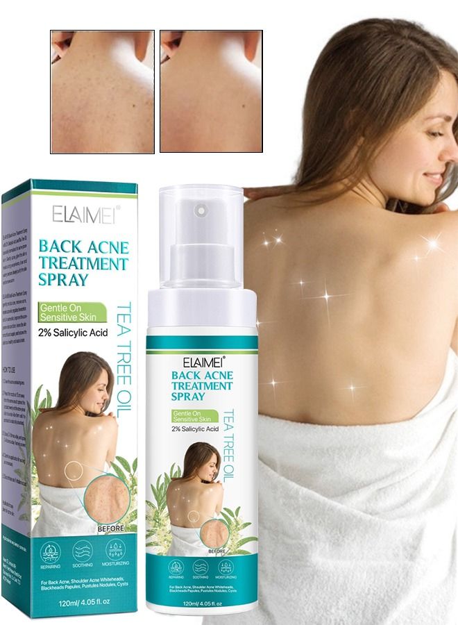 120ml Back Acne Treatment Spray 2% Salicylic Acid Body Acne Treatment with Herbal Formula Back Acne Solution Tea Tree Oil Spray Soothing and Moisturizing Spray for Sensitive Skin Back Acne Spray