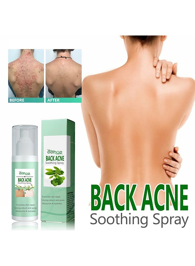 Back Acne Soothing Spray, Back Acne Spray, 2% Salicylic Acid Spray, Body Acne Treatment with Herbal Formula, Body Acne Spray, Tea Tree Oil Spray, Acne Treatment For Teens, Back Acne 120ml