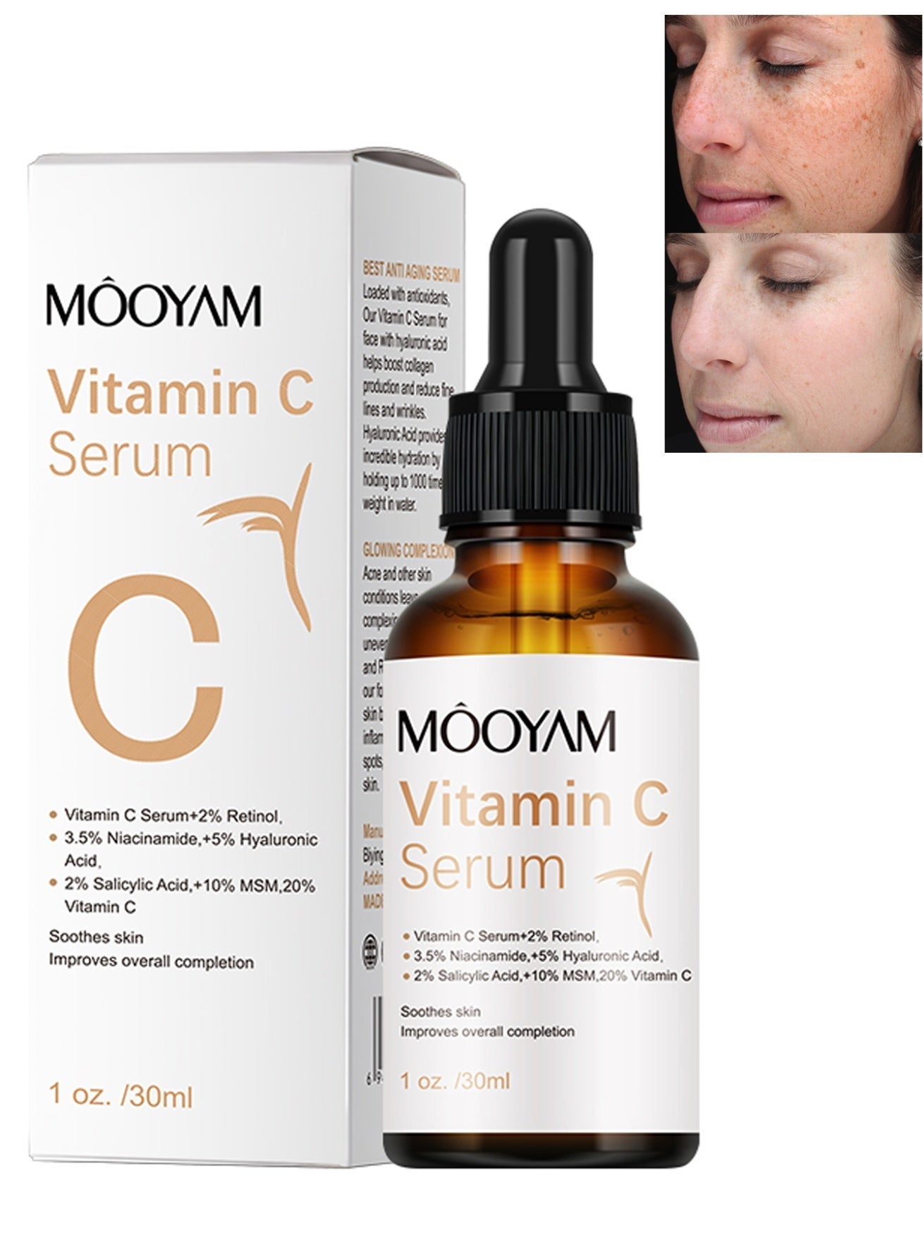 Vitamin C Serum for Face with Hyaluronic Acid Retinol and Salicylic Acid Anti Aging Facial Serum for Wrinkles Dark Spots and Brightening Improves Skin Tone and Texture 30ml