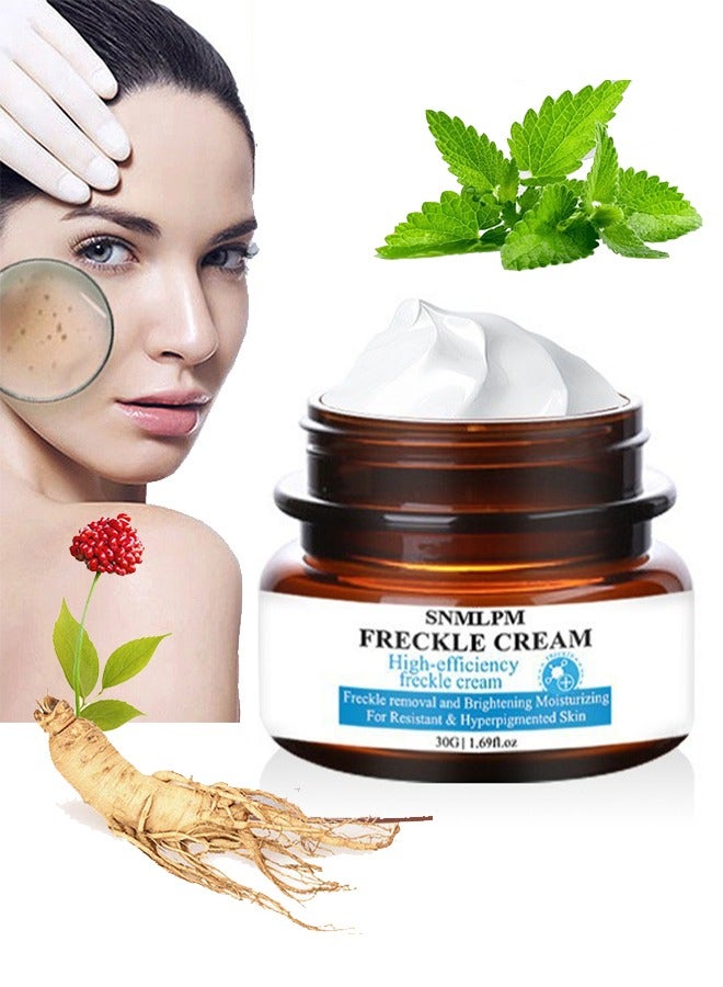 Freckle Cream,High Efficiency Freckle Cream Freckle Remover Brightening Deep Moisturizing Dark Spot Corrector Melasma Cream For Men & Women 30g
