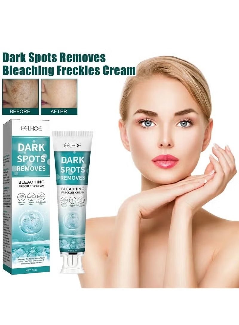 Freckle Whitening Cream, Remove Dark Spots, Melanin Pigmentation, Anti Aging, Brighten Melasma Lotion, Improve Melasma