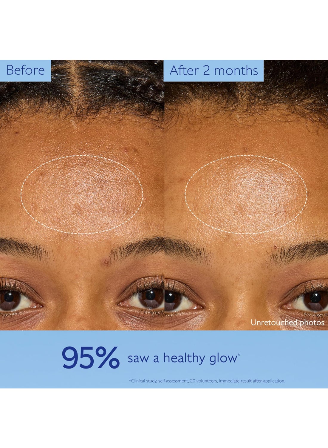 Vinoperfect Dark Spot Moisturizer - 50 mL - image 4