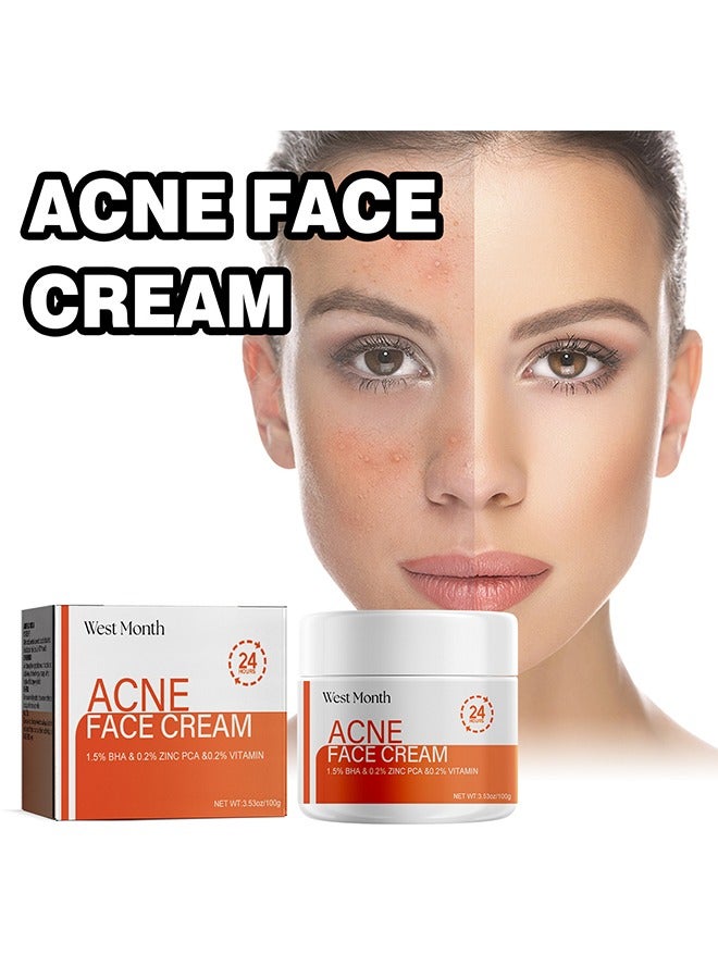 Acne Face Cream 100g, Acne Spot Treatment for Face & Acne Dots, Natural Cystic Acne Treatment, For All Skin Types, Premium Acne Scar Cream & Pimple Remover 100g