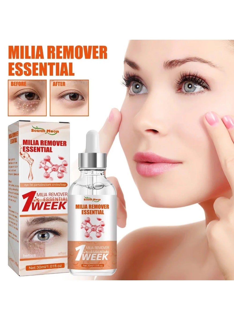 Fast Milia Remover, Milia Spot Treatment for Eye, Milia Remover Essential, Removes Fat Particles Under the Eyes, Tightens and Firms the Eye Area and Reduces Fine Lines
