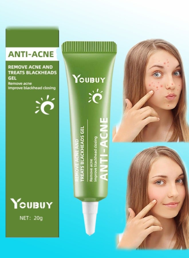 Anti Acne Remove Acne and Treats Blackheads Gel for Day Use Remove Acne Pimple and Treats Blackhead with Azelaic Acid Oil Control Shrink Pores Redness Relief Skin Lightening Scar Fade Cream Acne Remover Cream 20g