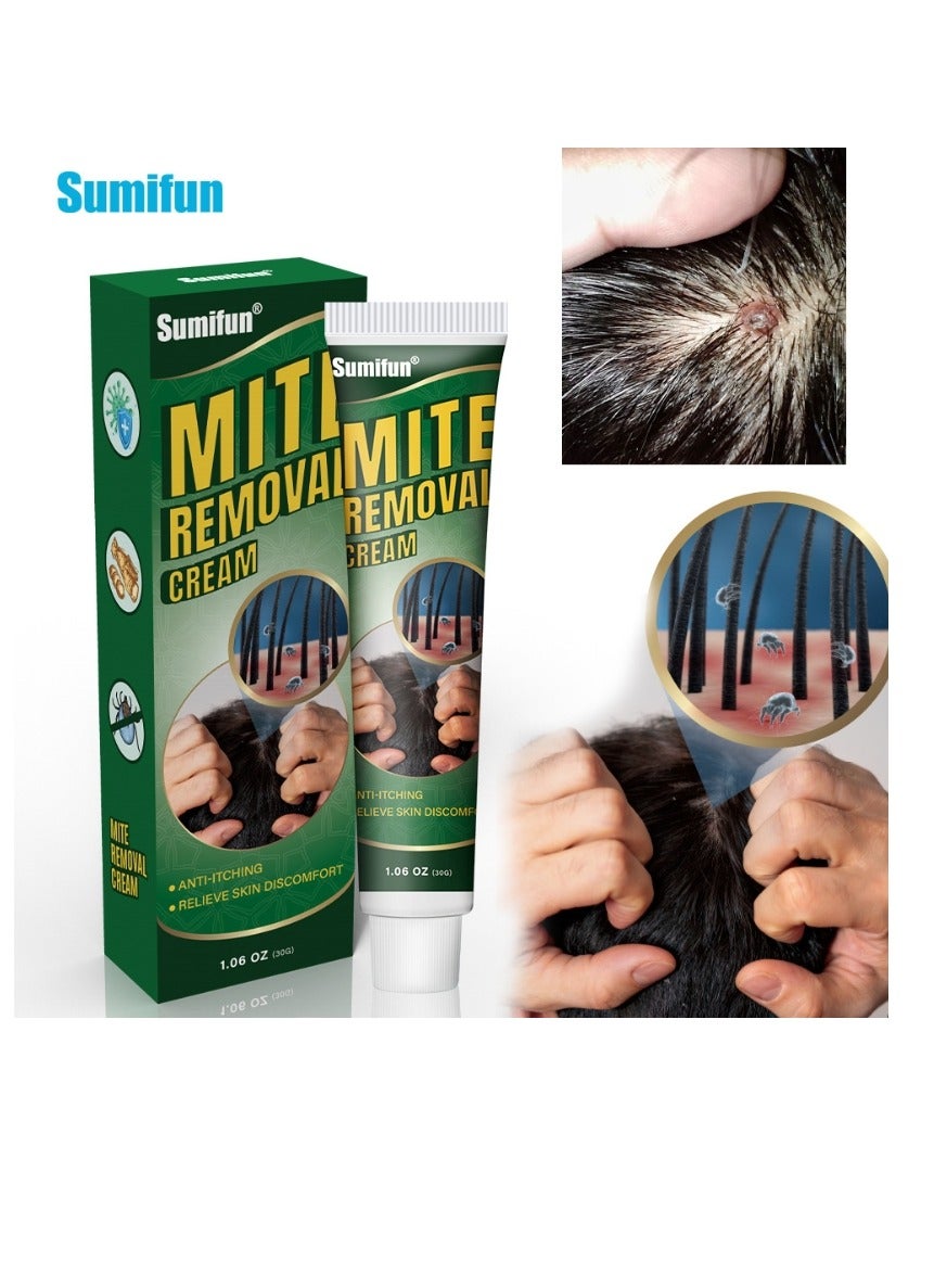 Mite Removal Cream-Tinea Capitis Antipruritic Cream For Folliculitis, Dermatitis, Dandruff, Mites, Itchy And Flaky Scalp, Treats Dandruff And Seborrheic Dermatitis 30g